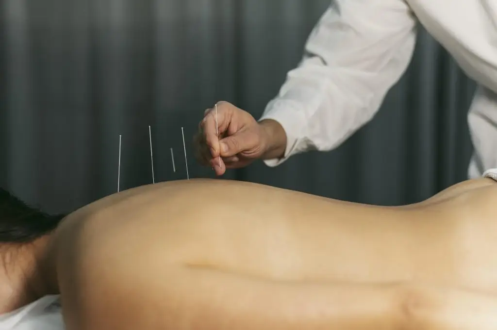 Acupuncturist in Leiden